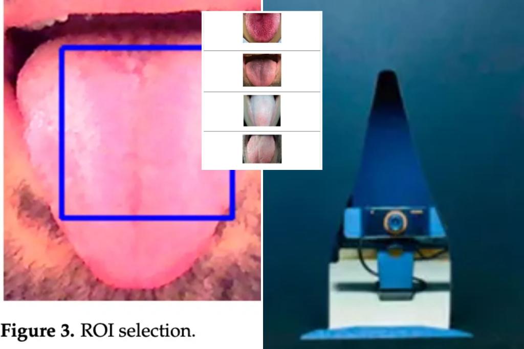 AI model 98% accurate in detecting diseases from a tongue photo